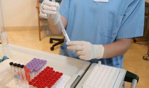 Un talón de Aquiles genético perjudica la lucha contra la hepatitis C