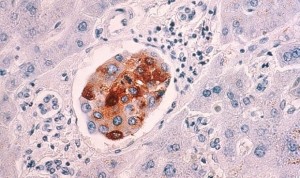 Una herramienta gratuita simplifica la investigación contra el cáncer