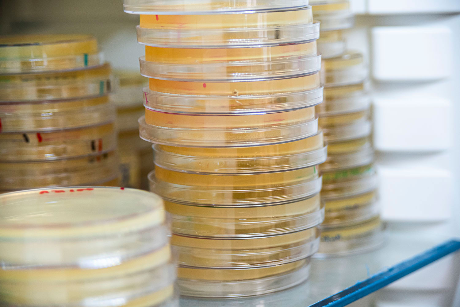 Identifican el coste fisiológico de mantener la resistencia microbiana en enterobacterias