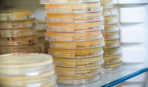 Identifican el coste fisiológico de mantener la resistencia microbiana en enterobacterias