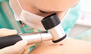 Una nueva técnica de Medicina Nuclear mejora la detección del melanoma