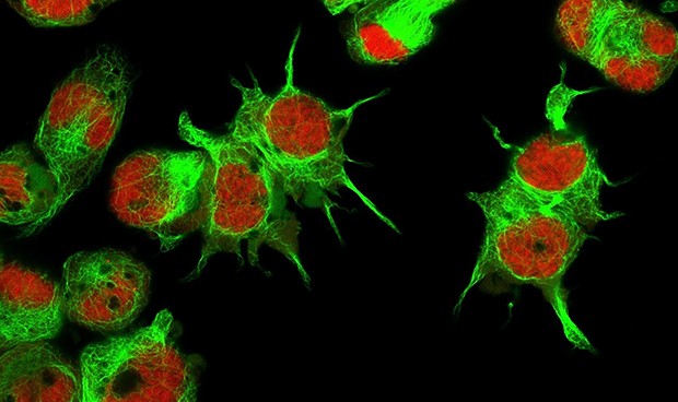 Una proteína identifica células madre cancerosas en niños de 2 y 3 años