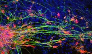 Una proteína, nueva diana terapéutica contra el párkinson