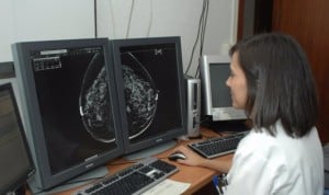 Usar IA en cribado de cáncer de mama aumenta su detección un 3‰