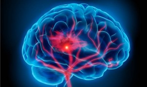 Vacuna Covid AZ: España investiga una muerte por hemorragia cerebral