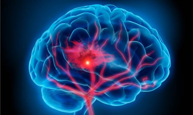 Vacuna Covid AZ: España investiga una muerte por hemorragia cerebral