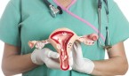 El VIH aumenta hasta 6 veces el riesgo de cáncer de cuello uterino