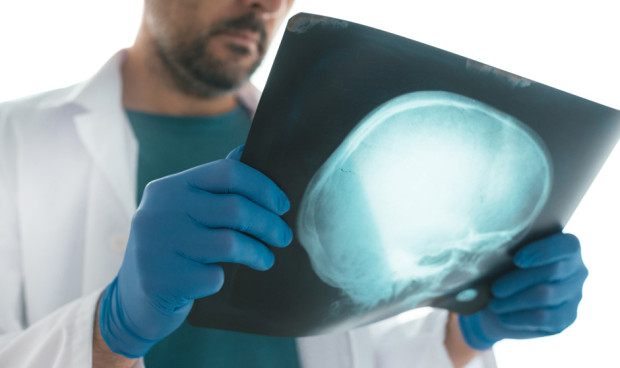 Unos investigadores de EEUU descubren un vínculo entre los tumores y los traumatismos cranoencefálicos.