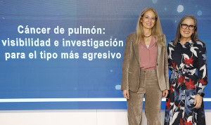 Visibilidad como llave para frenar el cáncer de pulmón de célula pequeña