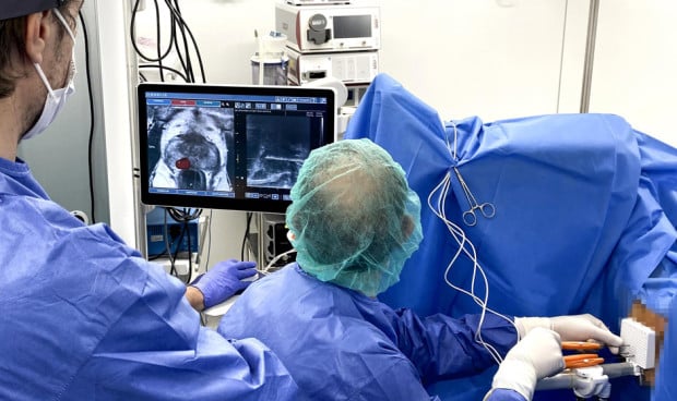 Vithas Arturo Soria usa la terapia focal para tratar el cáncer de próstata