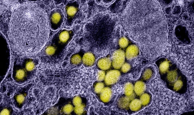 Coronavirus España hoy: confinamientos, test rápidos y nuevos datos