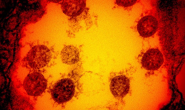 Coronavirus España, última hora Covid: avances sobre inmunidad y aerosoles