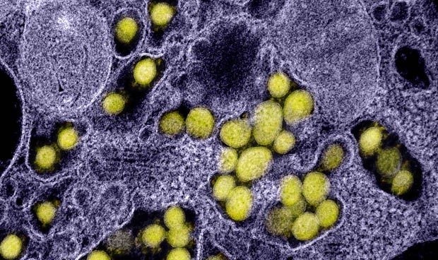 Coronavirus España, última hora hoy: nuevos casos y datos de la vacuna