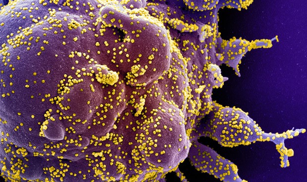 Coronavirus España, últimas noticias Covid: inmunidad y nuevos datos