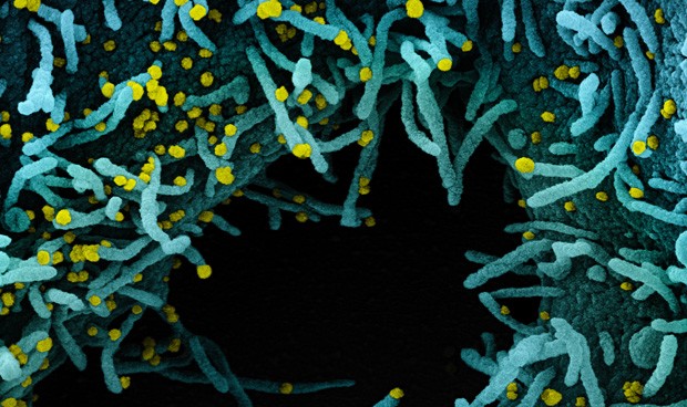Coronavirus España, últimas noticias: protestas, saqueos y confinamientos