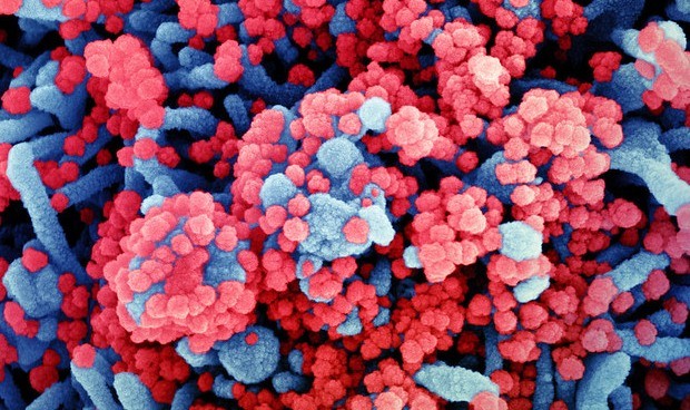 Covid-19 España en directo: últimas noticias de casos y brotes hoy