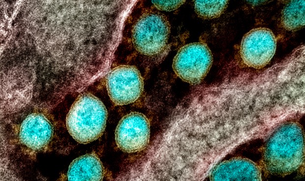 Covid-19 España hoy: rebrotes y nuevos datos, crecen los contagios