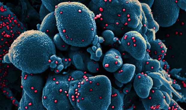 Covid-19 España hoy, rebrotes en directo: datos actualizados y última hora