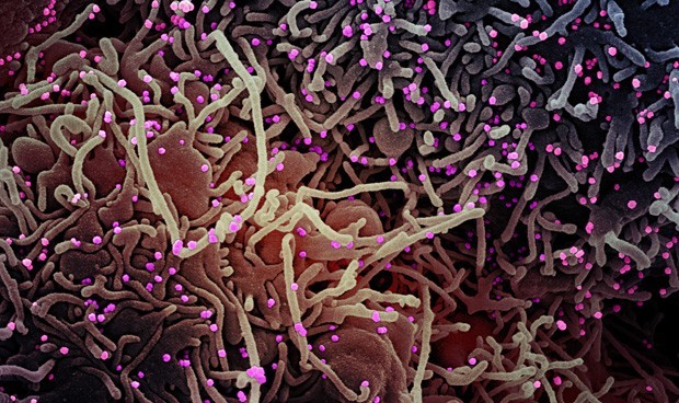 Covid-19 España: noticias en directo, última hora sobre rebrotes hoy