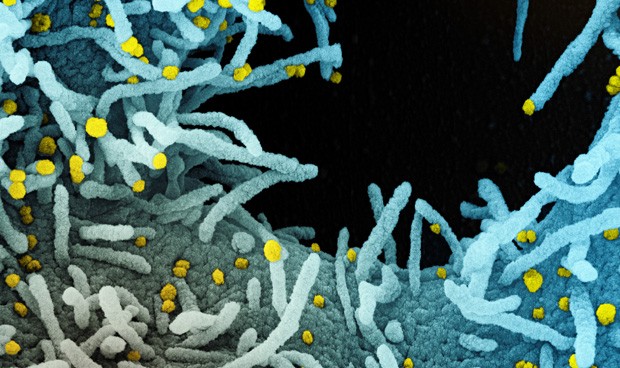 Covid-19 España, noticias hoy: nuevos rebrotes y aumento de contagios