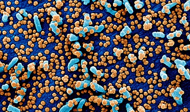 Covid-19 España última hora: aumento de contagios y nuevas restricciones