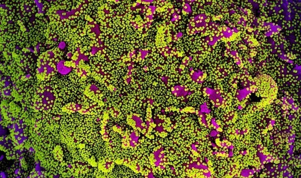 Covid-19 España, últimas noticias: vacunas para mayores de 65 y 80 años