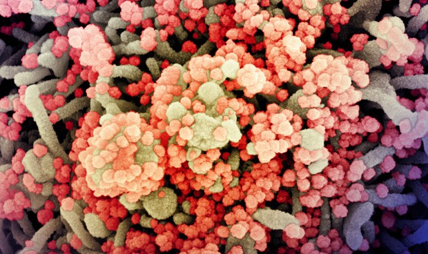 Covid-19 noticias hoy en directo: casos y rebrotes, pandemia de coronavirus