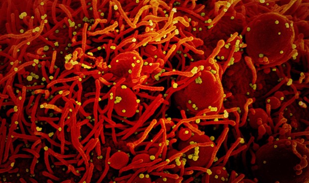 Covid-19 últimas noticias en directo: nuevos datos y repuntes en España