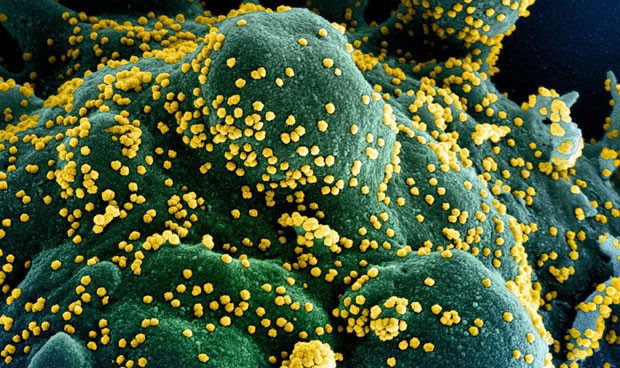 Covid-19 noticias hoy: pruebas PCR, vacuna, síntomas y rebrotes