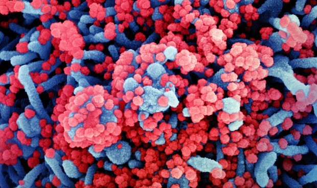 Covid-19 última hora en directo hoy: nuevos rebrotes y contagios 