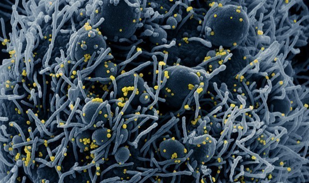 Covid-19 últimas noticias en directo: decisión sobre la vacuna Astrazeneca