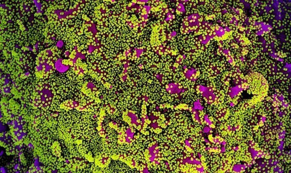 Covid-19 última hora: reparto de la vacuna de Janssen y bajan los ingresos