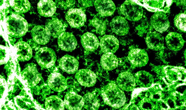 Coronavirus noticias en directo: sin inmunidad de rebaño en España