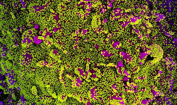 ÚItima hora coronavirus España hoy: nuevas restricciones y datos Covid