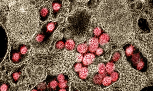 Últimas noticias coronavirus España hoy lunes: vacunas Covid y nuevos datos