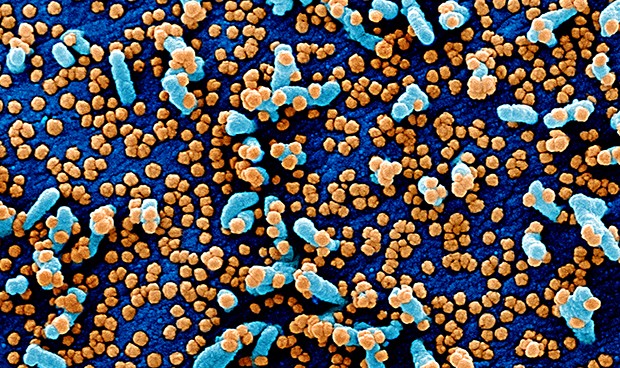 Coronavirus España, última hora: nuevos datos de la pandemia en directo 