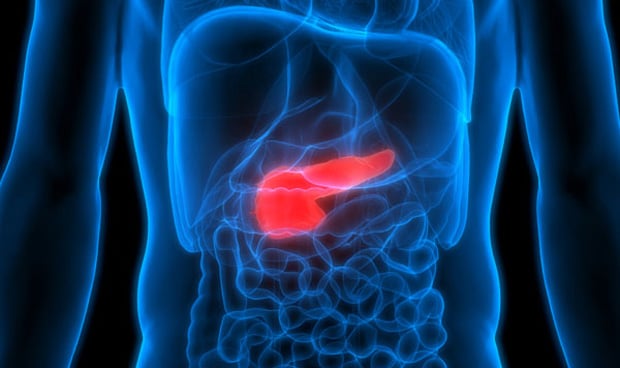 Infografía de un páncreas destacado en rojo sobre un torso humano en azul