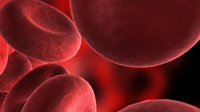 ¿Cómo se diagnostica la anemia aplásica?