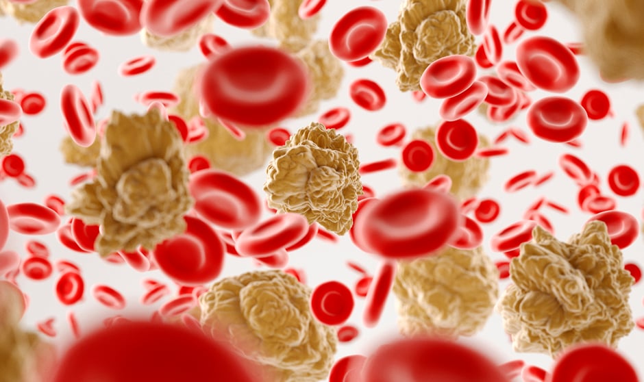 La Anemia de Fanconi produce un déficit en las células sanguíneas