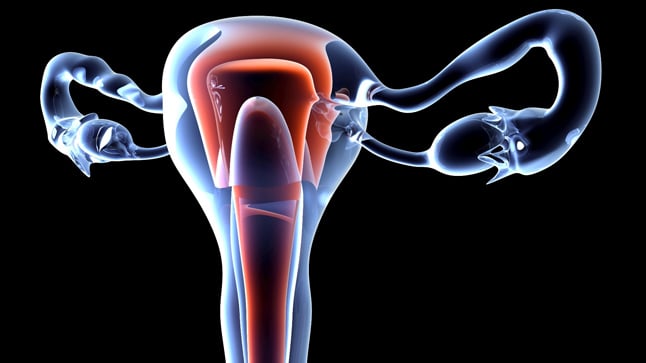 ¿En qué consiste la biopsia endometrial?