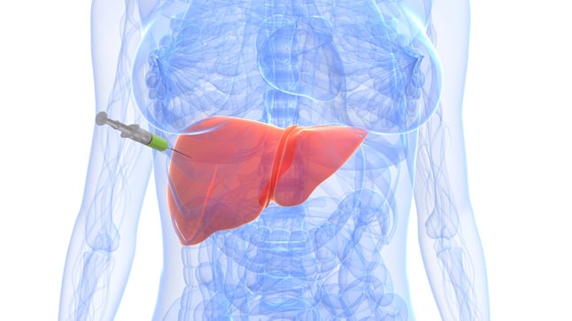 Contraindicaciones de una biopsia hepática