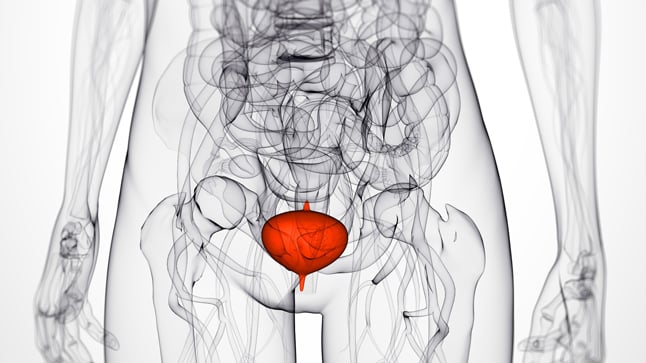 ¿Cómo se diagnostica el cistocele?