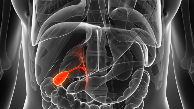 Causas, síntomas y tratamiento del colangiocarcinoma