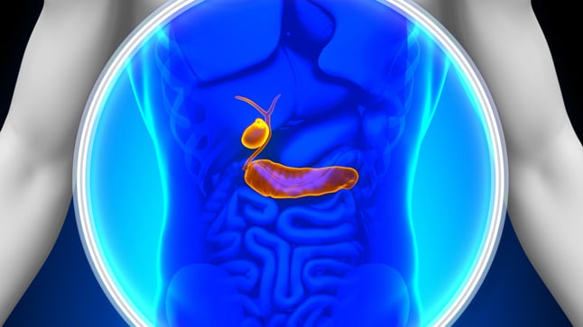 Causas, síntomas y tratamiento de la colangitis esclerosante primaria