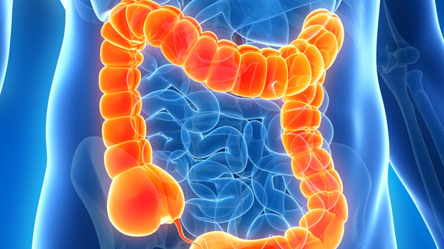 ¿Es contagiosa la colitis isquémica?