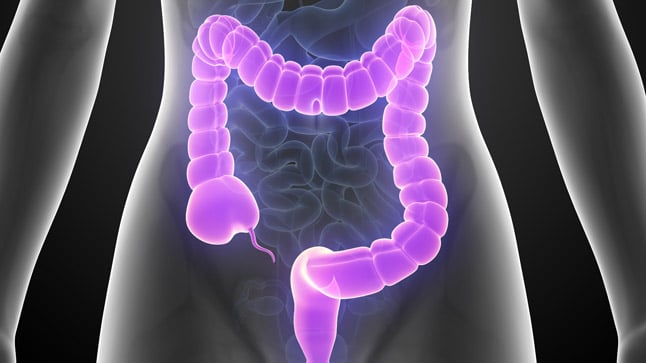 ¿Cómo se diagnostica la colitis por radioterapia?