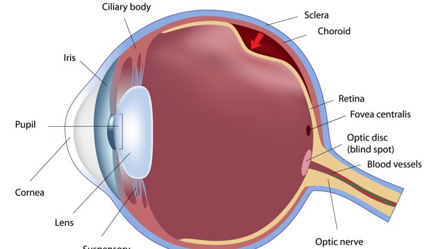 ¿Cómo se diagnostica el desprendimiento de retina?