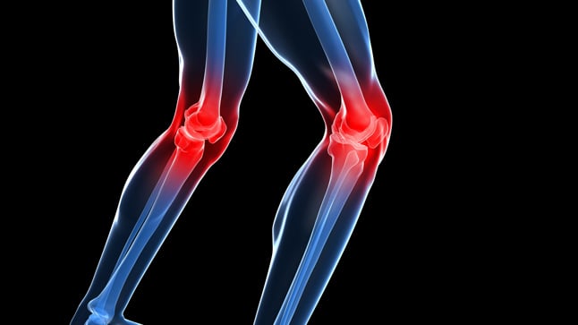 Por qué se produce el dolor de rodilla?
