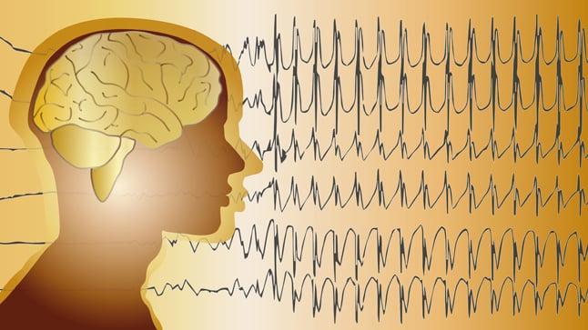 ¿Cómo se diagnostica la eclampsia?