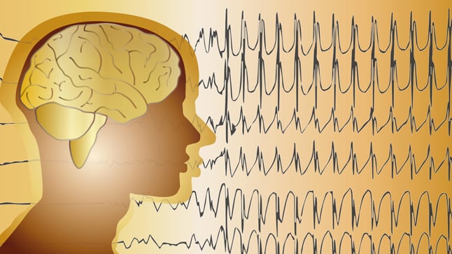 ¿Cuándo se solicita un electroencefalograma?